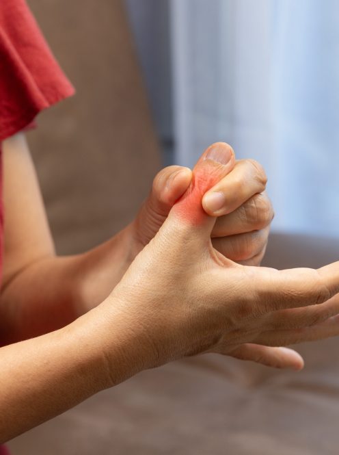 blood-clot-leg-pictures